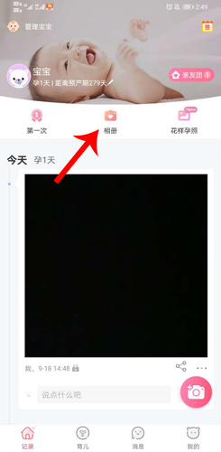 育兒寶上傳視頻：3步搞定，寶寶成長瞬間秒分享-景澄手游網
