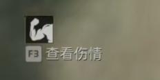 注射過程